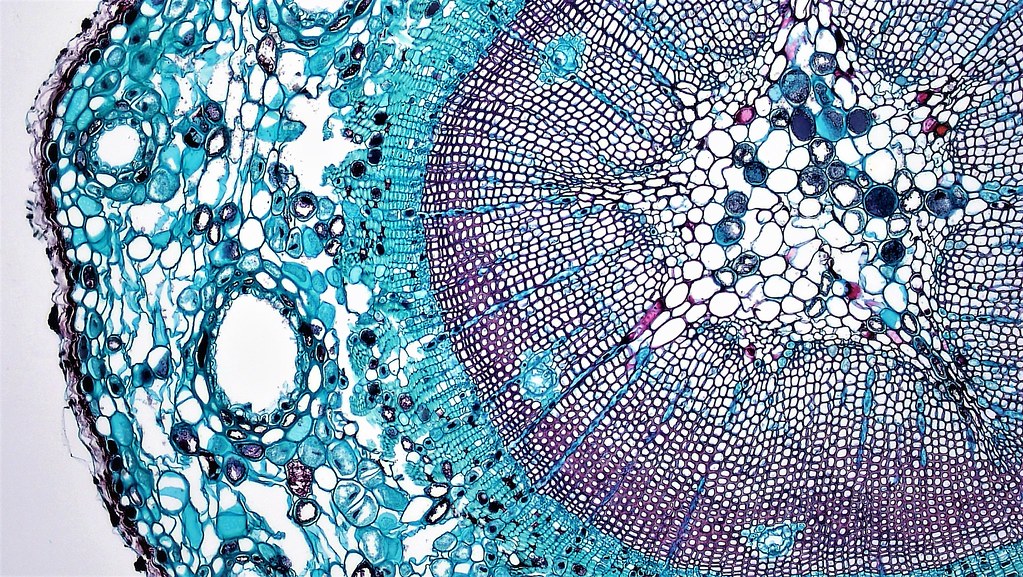 Ksilem aktif taşıma yapar mı? Ksilem özellikleri nelerdir?