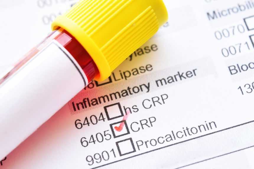 CRP Nedir? CRP Testinin Amacı